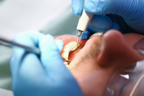 Best Dental Abscess Treatment in Nowthen, MN